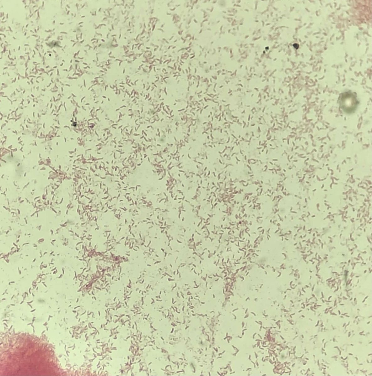 odie0222's tweet photo. Vibrio parahaemolyticus: Contaminated oysters 🦪 and seafood from fresh and salt waters leads to GI, occasional wound and septicemia. Oxidase + Indole + Lactose = and TCBS blue-green growth.
#PathTwitter #MedEd #pathBoards #pathtwitteraward #lab4life #IdBoardReview #microbiology https://t.co/Bk2Wp9fjcp