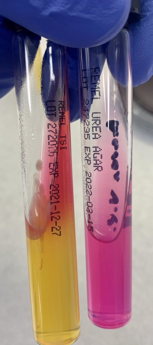odie0222's tweet photo. Vibrio parahaemolyticus: Contaminated oysters 🦪 and seafood from fresh and salt waters leads to GI, occasional wound and septicemia. Oxidase + Indole + Lactose = and TCBS blue-green growth.
#PathTwitter #MedEd #pathBoards #pathtwitteraward #lab4life #IdBoardReview #microbiology https://t.co/Bk2Wp9fjcp
