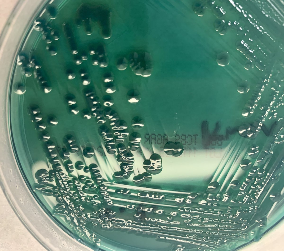 TCBS agar growth close up: Does not utilize sucrose, produces blue-green colonies. Vibrio cholera will be yellow in agar