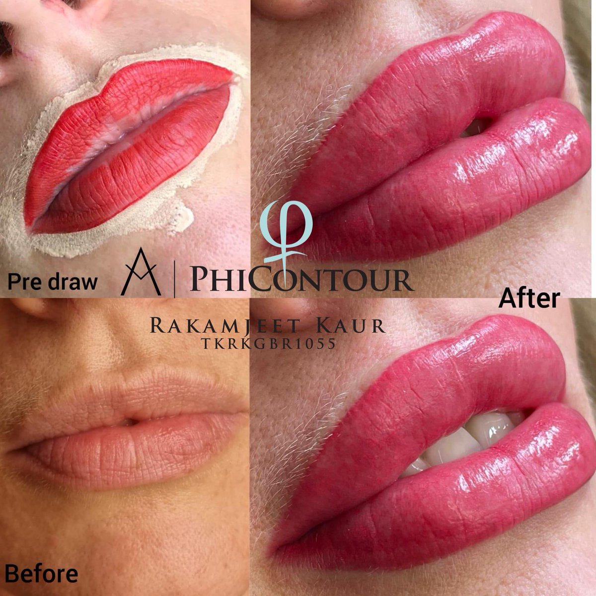 Great juicy lips without Botox

#Lipcontour is about playing with light, shade &amp; texture lips 👄 

#PhiContour #NoticeableColour #Colour #Pigment #Marylebone #vlogger #BeautyTips #BeatyEnhanced #Makeup #Lips #beauty #JulyRain #londonrain #beautygoals #lipservice #BeautySecrets