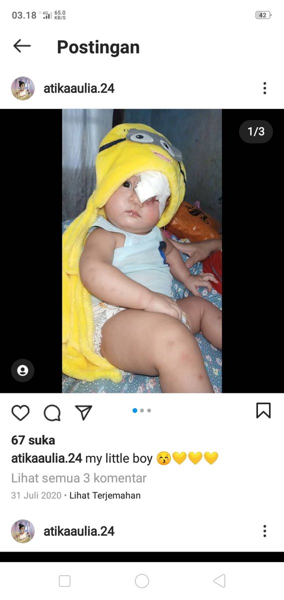 Dia single parents,yang harus menghidupi anaknya,yang lagi kena kanker.kepada teman semua minta tolong bantuanya.smoga bisa meringankan beliau.
Cc. @Natali_Cristi3n 
@Leonita_lestari 
<a href="/Bengkeltanah2/">🇮🇩Bengkeltanah🇮🇩</a> <a href="/triajaaa/">tria 👠</a> <a href="/AmbarwatiRexy/">Rexy Ambarwati</a> @alextham878 <a href="/ChusnulCh__/">IG chchotimah</a>  bisa hubungi beliau