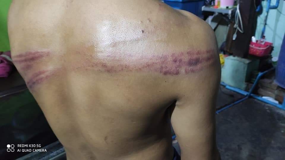 YarMoeAung3's tweet photo. Last night in Mandalay, a young man was violently beaten by the military council while searching for oxygen for his family at 12 o'clock at night. 
#whathappeninginmyanmar 
#July20Coup
#MyanmarNeedsO2 https://t.co/4cPmSpkAbt