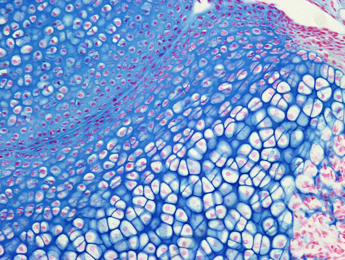 NeuroAlc's tweet photo. #SciencePhoto_IN
"Levante Beach with anti-Covid19 separation" 
Author: Cristina López Blau 
Lab: Dra. Ángela Nieto @NietoAngela
"Cartilage staining in mouse bone section. Imaged with a @LeicaMicro DMR microscope" https://t.co/3sHIwQeNWw