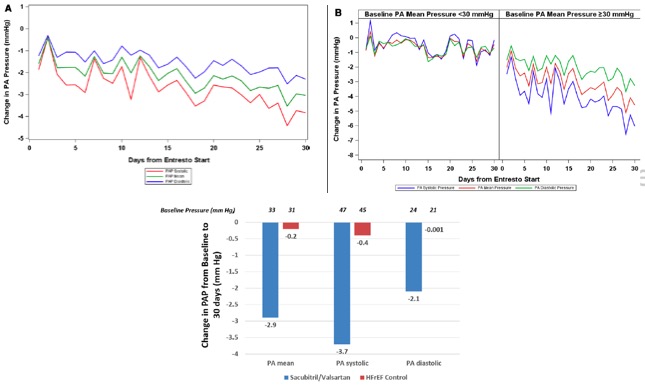 Novel data from ambulatory hemodynamic monitoring using #CardioMEMS in the Post-Approval Study suggests significant reductions in elevated PA pressures post initiation of #ARNI. @CircHF