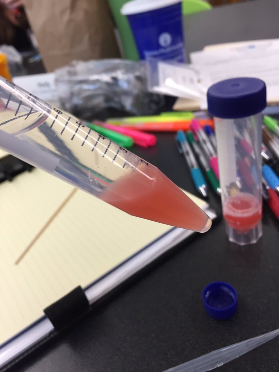 hollyastuart's tweet image. What did I do today, you ask? I had a blast during Day 1 of @RoperMountain’s Science PLUS Teacher Institute! Punnett Squares, DNA extraction, chromosome analysis, dominant and recessive gene case studies - whew!!

#stuartscience #teachbetter #tlap #scitlap