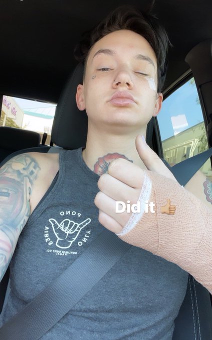 Had a successful surgery on my wrist today 👍🏼 Send me cute animals &amp; memes n stuff while I recover &hearts;️<a href="/tag/10yearchallenge"class="tags"><span>#10yearchallenge</span></a>