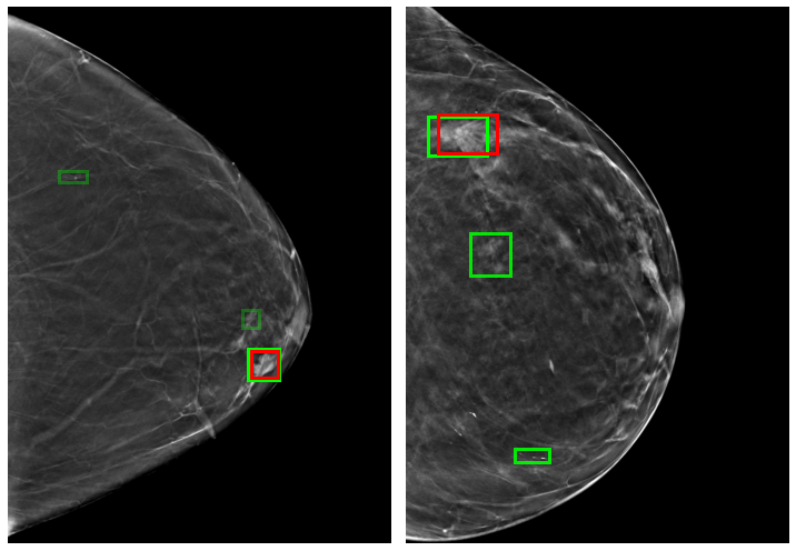 Jungkyu Park tweet media