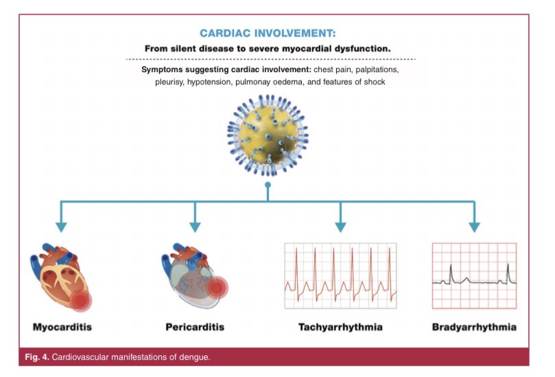 SIAC Miocardiopatías (@siac_mcp) on Twitter photo ¿Existe afección cardiovascular por Dengue?
Si! En esta revisión 👇🏾 <a href="/drdargaray/">Diego Araiza MD</a> <a href="/EmmanuelScatu/">Emmanuel Scatularo MD 🇦🇷</a> <a href="/clara_clarais/">clara saldarriaga</a> <a href="/lucreciamburgos/">Lucrecia M. Burgos, MD</a> <a href="/adribaran/">Adrian Baranchuk MD FACC FRCPC FCCS FSIAC</a> et al, nos platican de las manifestaciones CV del dengue 🦠
Imperdible revisión! ¿Existe afección cardiovascular por Dengue?
Si! En esta revisión 👇🏾 <a href="/drdargaray/">Diego Araiza MD</a> <a href="/EmmanuelScatu/">Emmanuel Scatularo MD 🇦🇷</a> <a href="/clara_clarais/">clara saldarriaga</a> <a href="/lucreciamburgos/">Lucrecia M. Burgos, MD</a> <a href="/adribaran/">Adrian Baranchuk MD FACC FRCPC FCCS FSIAC</a> et al, nos platican de las manifestaciones CV del dengue 🦠
Imperdible revisión!