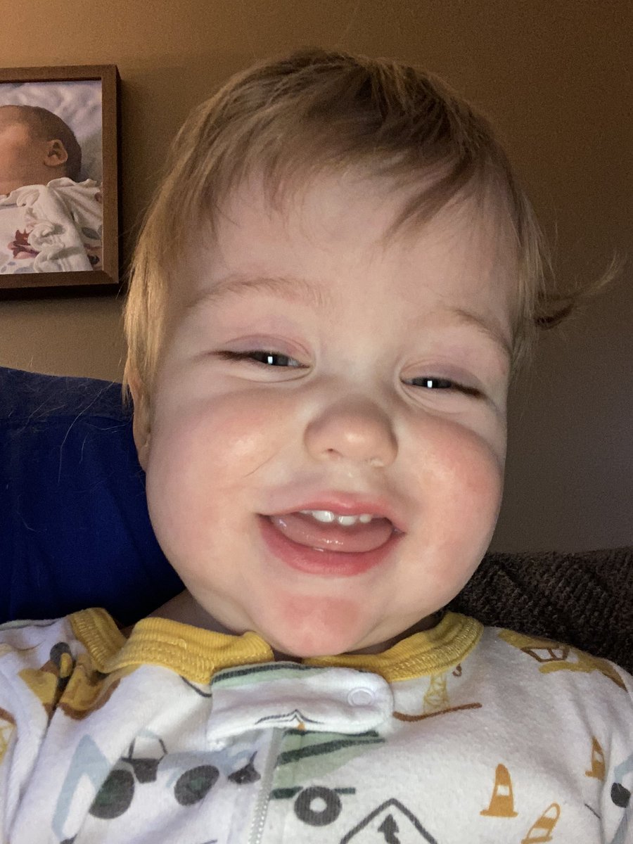 ndjdbomber's tweet photo. This little guy got a clean bill of health from Cincinnati Children’s Hospital today! He’s overcome a lot and just keeps getting stronger. https://t.co/7xTDZHPzxY