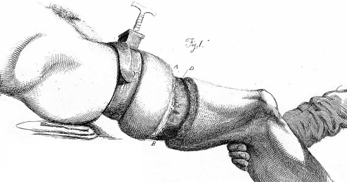 God_Of_Egypt16's tweet photo. Sientes que alguna parte de tu cuerpo sobra al punto de querer librarte de ella. Ojalá y no, porque estamos en presencia de lo que supone un desorden psiquiátrico de los menos conocidos y hoy te comentaré de que va. https://t.co/S5Jk7aOd6y