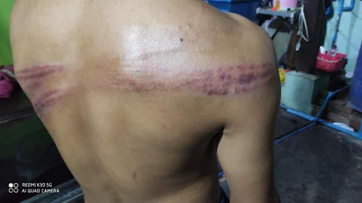 Shwe Yi (@shweyi22665406) on Twitter photo Junta terrorists reportedly beat a civilian who was just carrying Oxygen tanks for Covid-19 Patients with metal rods, pellets and a jolt in #Mandalay,on July19. #WhatsHappeningInMyanmar #July21Coup <a href="/SecBlinken/">Secretary Antony Blinken</a> <a href="/USEmbassyBurma/">U.S. Embassy Burma</a> #CrimesAgainstHumanity Junta terrorists reportedly beat a civilian who was just carrying Oxygen tanks for Covid-19 Patients with metal rods, pellets and a jolt in #Mandalay,on July19. #WhatsHappeningInMyanmar #July21Coup <a href="/SecBlinken/">Secretary Antony Blinken</a> <a href="/USEmbassyBurma/">U.S. Embassy Burma</a> #CrimesAgainstHumanity
