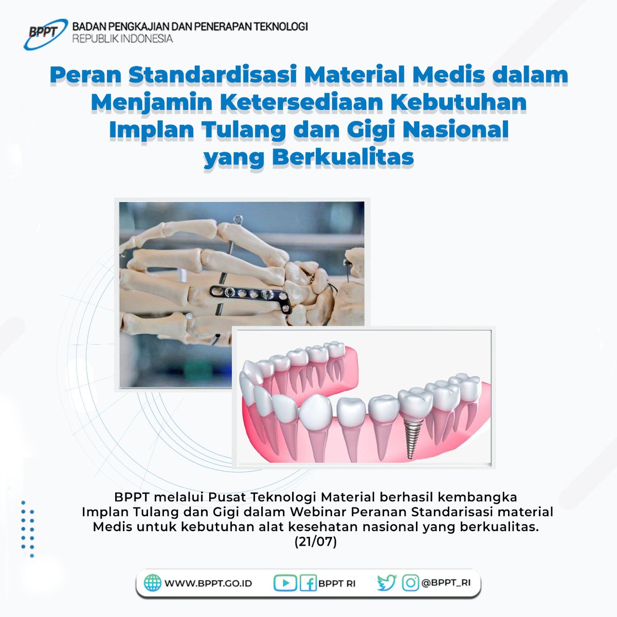 BPPT_RI's tweet image. Salam Teknologi, Teknopren, BPPT melalui @PTM_BPPT berhasil kembangkan Implan Tulang dan Gigi dalam Webinar Peranan Standarisasi material Medis untuk kebutuhan alat kesehatan nasional yang berkualitas.
 
#BPPTTeknologiCerdas
#BPPTJagoanInovasi
#BPPTSolidSmartSpeed