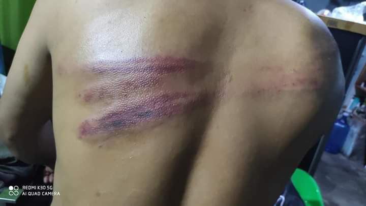 BSLTEmpire's tweet photo. Junta terrorists beat a civilian who was just carrying Oxygen tanks for Covid-19 Patients in #Mandalay, on July19.   

JUNTA USES COVID AS WEAPONS 

#WhatsHappeningInMyanmar #July21Coup https://t.co/wavespF4t5
