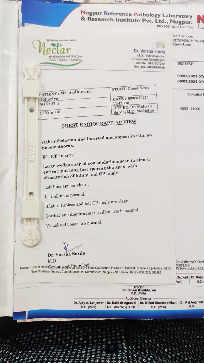 Akash_0107's tweet photo. @IlaajIndia @SoodFoundation
 Sir mere papa ko aspiration pneumonia aur sepsis ho gya hai 1 saal pehle unhe head injury hue thi jisme hamara sab paise kharch ho gaye ab kuch samajh ne aara sir ham kaise karein hill 5 lakh baan chuka hai air 3.5 lakh ka aur estimate hai https://t.co/AS7BdJStdH
