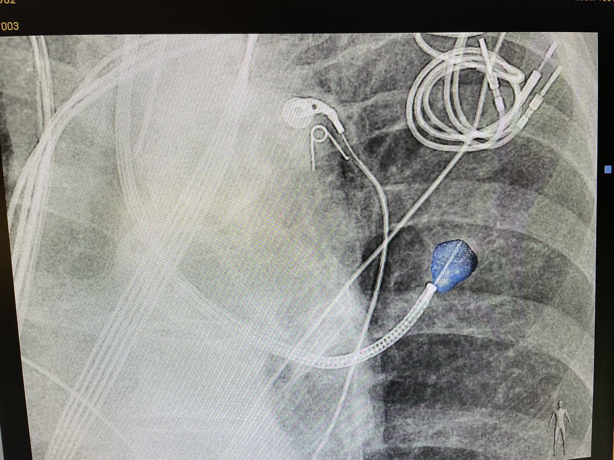 Alberto E Revelo tweet media