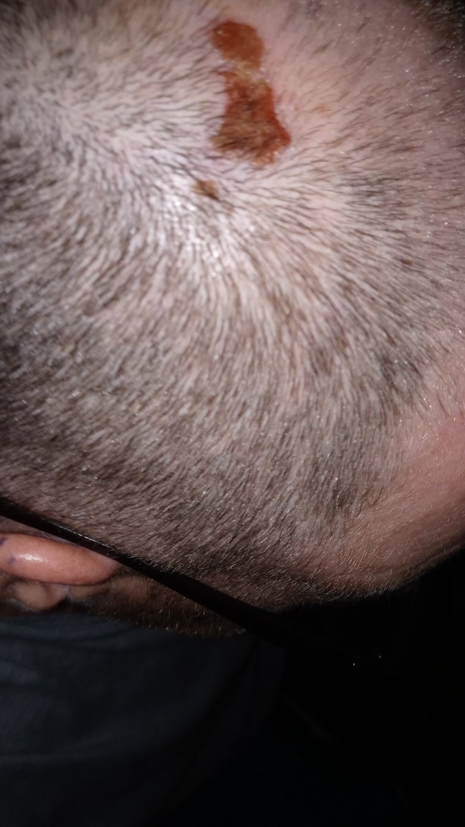 NEW,PAIN PAIN PAIN PAIN PAIN !( ?