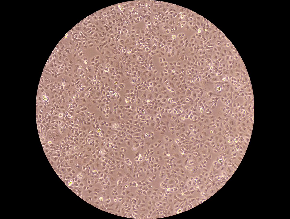 katydidnt6's tweet image. We have a new microscope and I LOVE IT OMG IT TAKES PHOTOS AND SENDS THEM TO MY PHONE.