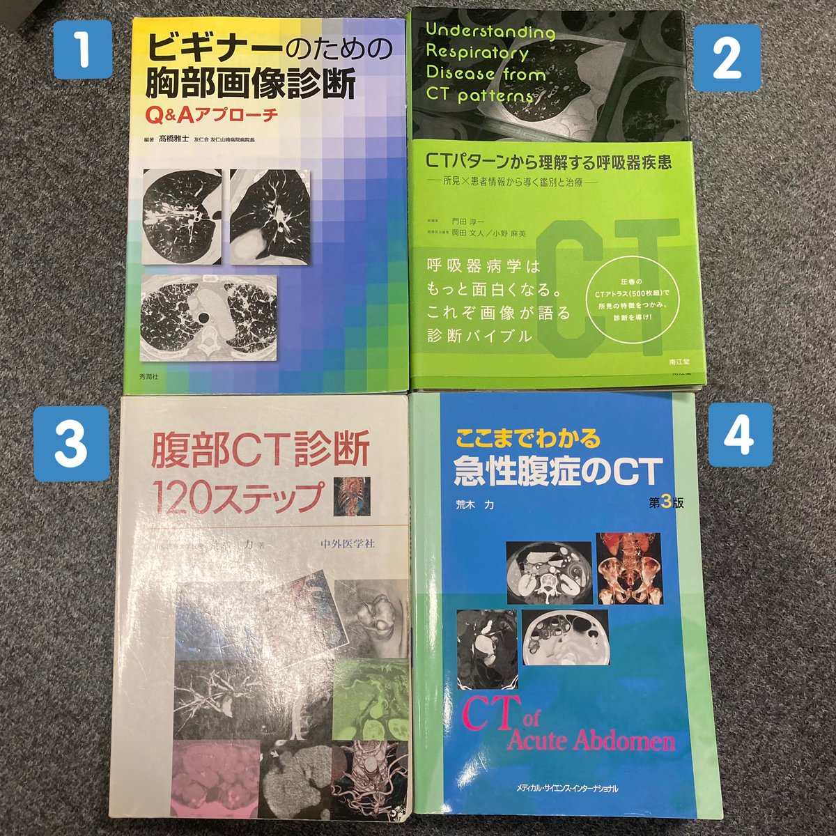 その他　CTパターンから理解する呼吸器疾患　所見×患者情報から導く鑑別と治療