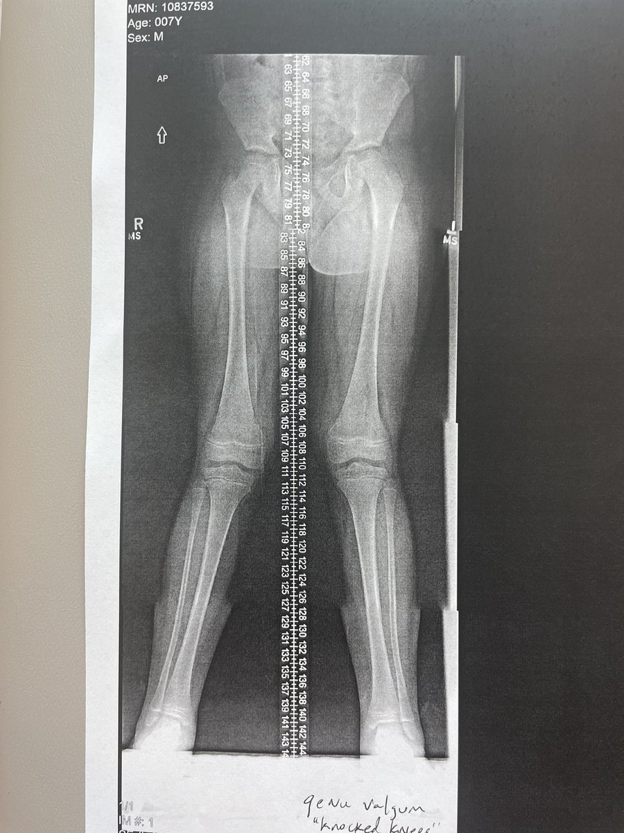 EstherCohen1031's tweet photo. Knock knock. Who’s there?  Leo’s knees!  Haha https://t.co/Aj52fTuldJ