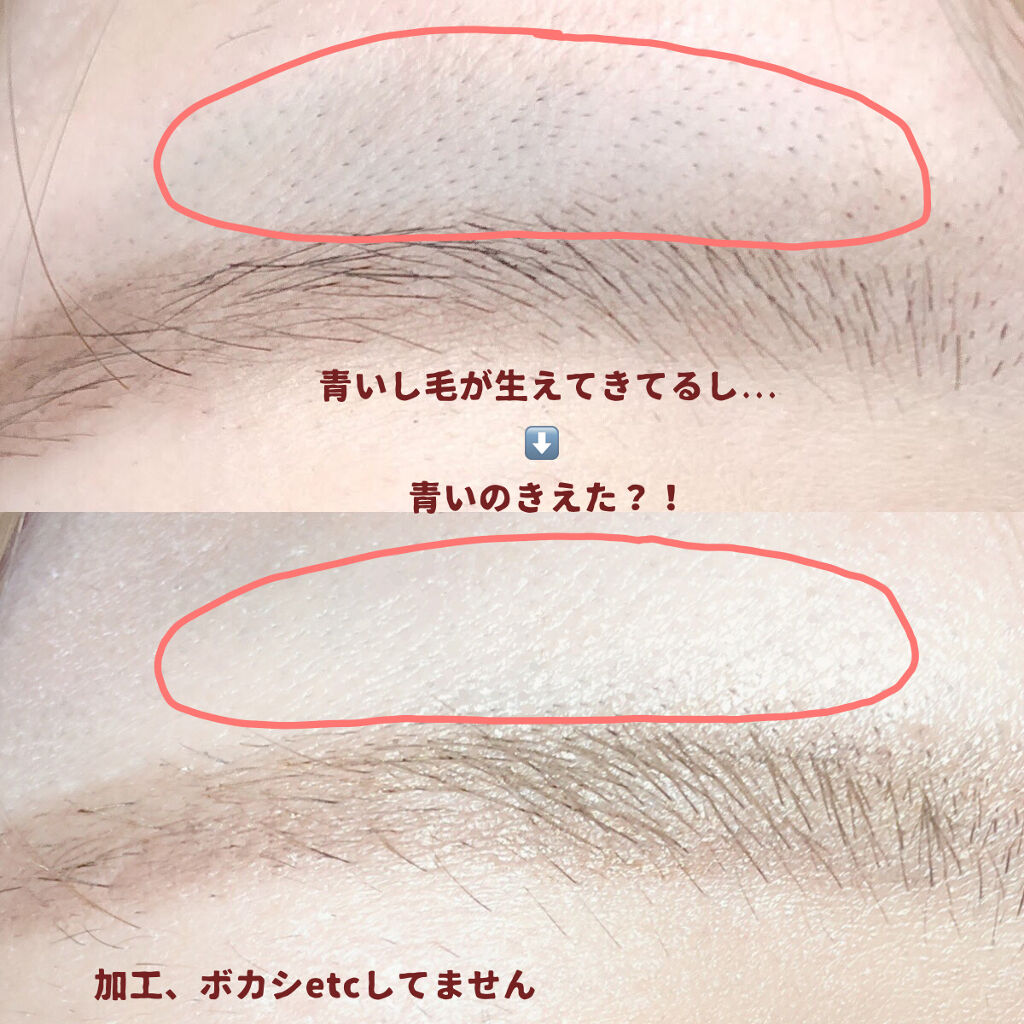 Lips リップス 今回は 沢山リクエストを頂いた眉毛の剃り跡が青くなる現象を抹消します 方法は3つ 剃る 前に蒸しタオルを眉毛に当てる 太い毛は抜く コンシーラーで隠す 1度やれば永久に青みが無くなる訳では無いので 定期的にやることを