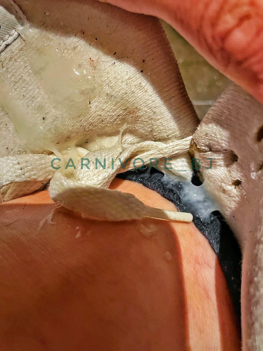 喷在自己脚踝上有点爽