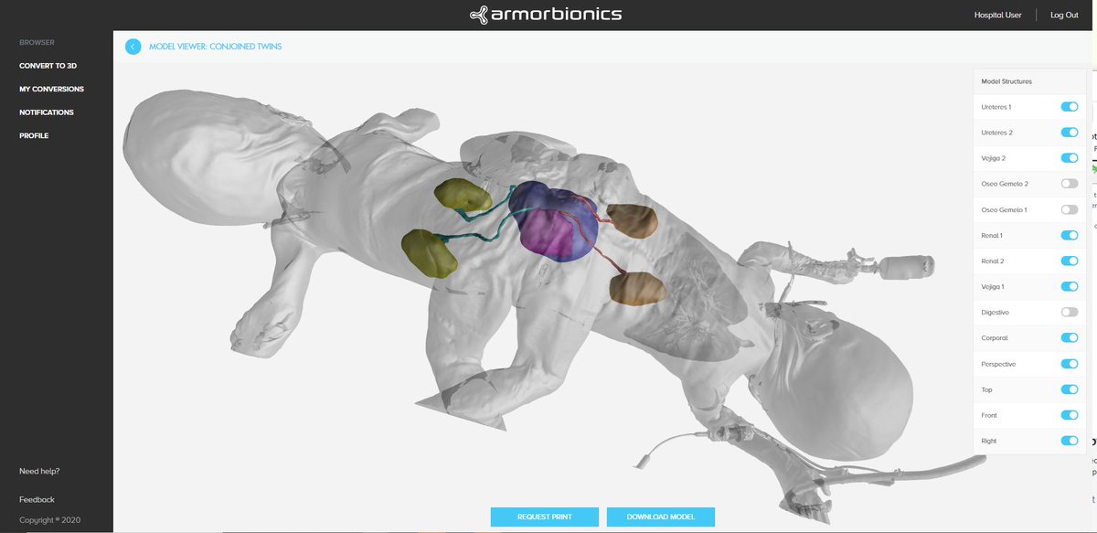 Armor Bionics tweet media