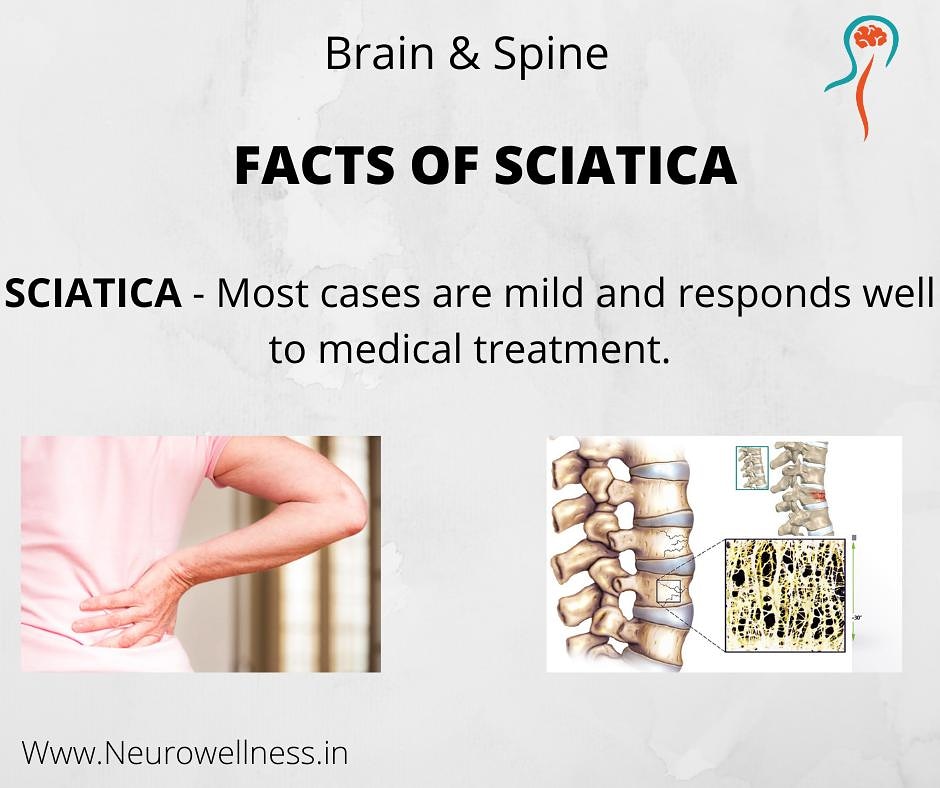 neurowellnes's tweet photo. #neurowellness  #spinehealth #discbulge #backpaintreatment #DiscProblems #DiscProlapse #SpineSurgeon #spinecare #sciaticarelief #sciaticapainrelief #Fortishospital #fortishospitalcunninghamroad, https://t.co/jfhRATg8UA