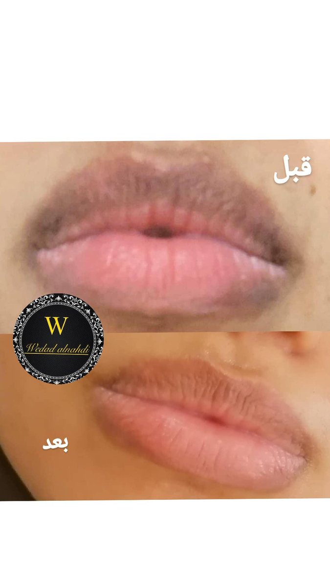 Wedadmicro tweet picture