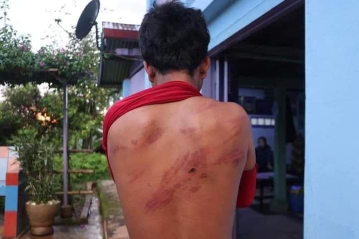 YarMoeAung3's tweet photo. In Man Aung, a military council accused a villager of stealing charcoal, tied his hands behind his back and beat him.
#SaveMyanmarpeople
#WhatsHappeningInMyanmar 
#August3Coup https://t.co/eHwlNdrGjQ