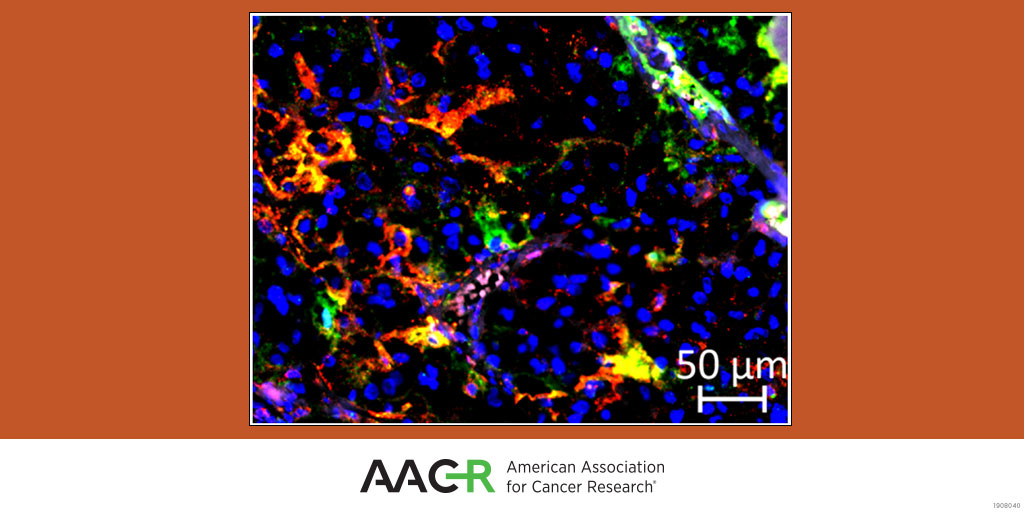 CIR_AACR's tweet photo. This #CIRSpotlight discusses an article that IDs #complement components as prognostic markers in #ccRCC. Read more here now! https://t.co/9tiKtmuiBH  @MaximeMeylan @CremerIsabelle @sautesfridm https://t.co/MQ5iHTJo7B