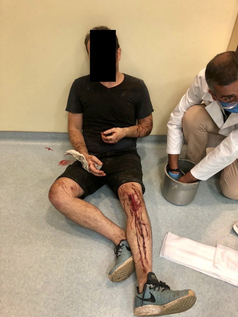wissamboueri's tweet photo. صرلي سنة ناطر تأعرف ليش صار هيك! وعدتونا بخمس ايام!!!
صراحة من معراب لعين التينة مرورًا بحزب التكيلا 🦓 🦓 فيكن يا حمير بالبيجاما.. مش خايف منكن! زعلان عالحمير يلّي بعدن وراكن.. 
#٤آب
#لن_ننسى https://t.co/BAfs3fg8XG