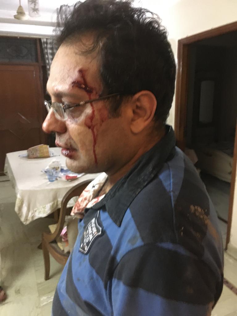 .<a href="/DCPSouthDelhi/">DCP South Delhi</a> plz take note of a murderous attack on Mr Kapil Puri, a resident of G block, NDSE-II. He is undergoing treatment at AIIMS Trauma center. His son called me to inform that the attackers r in the hospital eyeing their movements n on discharge they may be re-attacked.