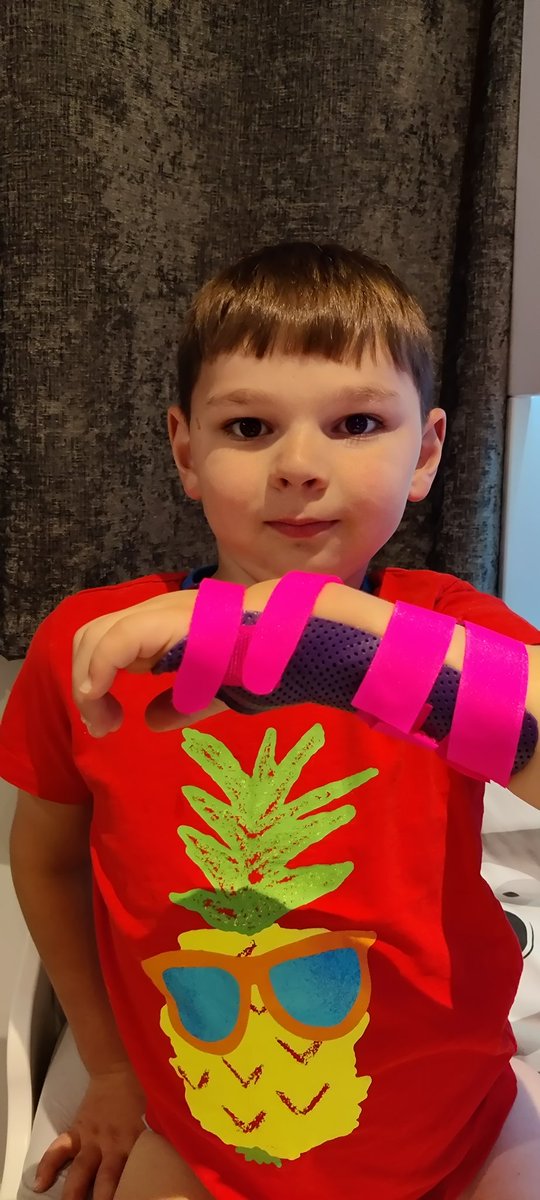 Tony Hudgell BEM (BCyA) Paula Hudgell OBE (@paula_hudgell) on Twitter photo The not so glamorous side to 🐻 2 Hospital appointments today in London <a href="/EvelinaLondon/">Evelina London</a> for new splint he chose purple & hot pink 🤣🤣 🤭
Massive thank U 2 the black cabbie who wouldn't let us pay & said to Tony "your the most famous person I have had in my taxi" ❤️
#blackcab The not so glamorous side to 🐻 2 Hospital appointments today in London <a href="/EvelinaLondon/">Evelina London</a> for new splint he chose purple & hot pink 🤣🤣 🤭
Massive thank U 2 the black cabbie who wouldn't let us pay & said to Tony "your the most famous person I have had in my taxi" ❤️
#blackcab