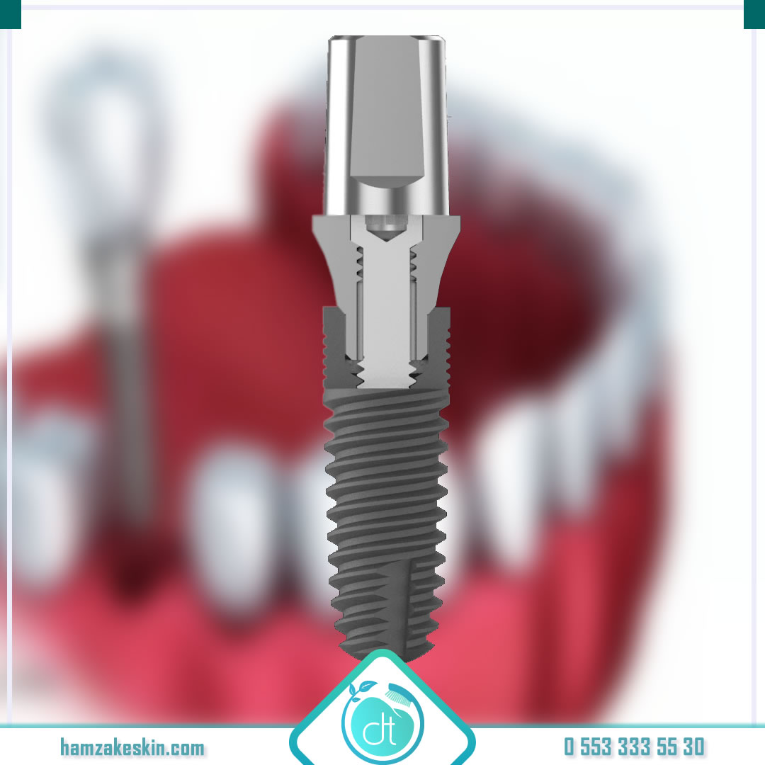 🔹 Nucleoss implant olarak sizlere yüksek kaliteli implantlar ile kalıcı bir tedavi, estetik bir gülüş kazandırmaktayız. 
🔹 Nucleoss İmplant Aklınıza Takılan Her Şey Burada 👉 bit.ly/2TRXyS7 

#nucleoss #kaplama #beyazlatmafiyatları