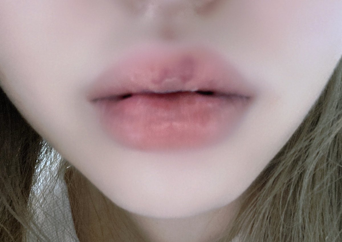 唇整形 Twitter Search