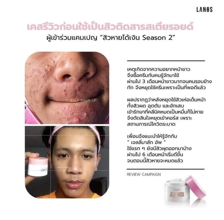 GamgamOfficial's tweet photo. รักษาสิวโหดทุกเคสจ้า หลายคนที่เป็นสิวหนักๆก็ไม่คิดว่าสิวจะหายได้ ต้องมาลองตัวนี้กันด่วน! ใช้โครตดี มีแต่รีวิวคนใช้จริงล้วนๆ  #jellymaskup 
#howtoperfectสิว #ใช้ดีบอกต่อสิว #รีวิวสกินแคร์ https://t.co/HBt3WG8fjm