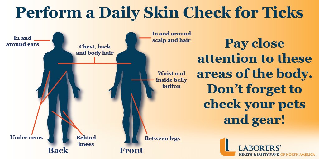 LHSFNA's tweet photo. #Lyme disease can cause serious health complications. Make sure you check these commonly missed areas.  #LymeDisease #Ticks #SunSensePlus2021 https://t.co/vQOGotbGDk