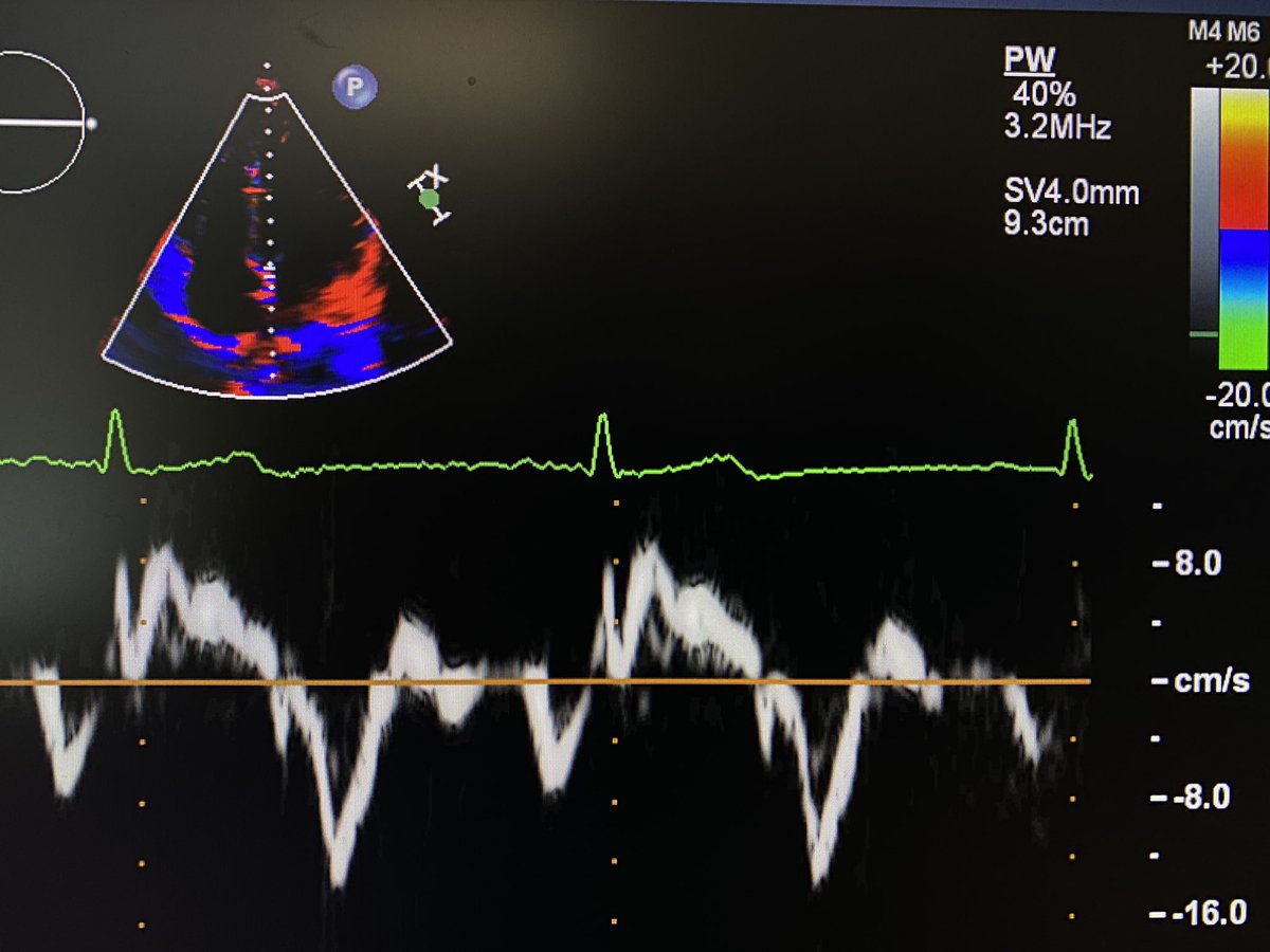 V.L.Sorrell, MD (@CASEfromASE EIC) tweet media