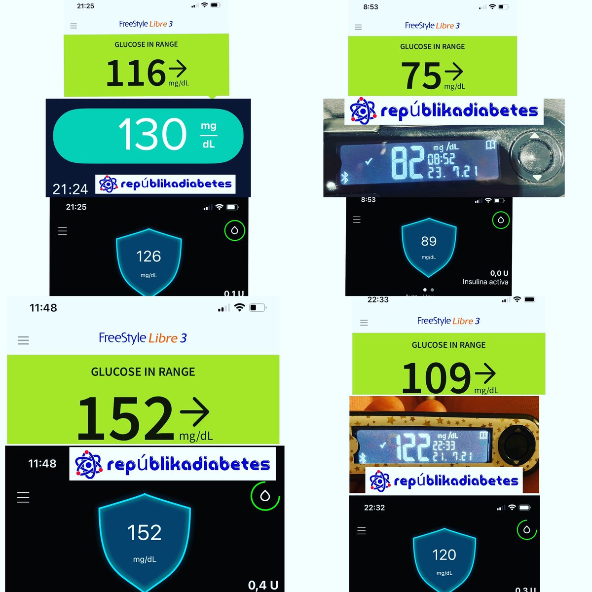 Aquí os actualizo medición #freestylelibre3 #guardian3 #glucemiacapilar #diabetesp