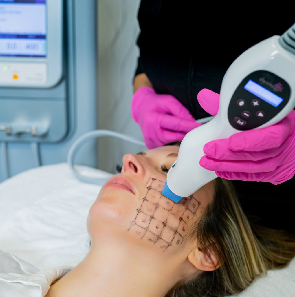 MD_Spa's tweet image. Did you know, we are one of the leading clinics for Thermage treatments?
Call now to book your complimentary consultation and see how this non invasive skin tightening treatment can help you!

#yeg #botox #beauty #skincare #medspa #juvederm #vivier #fillers #organic