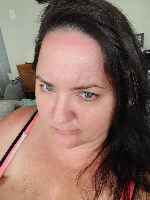 Looks like I forgot to sunscreen the very top of my forhead haha! I'm a doofus! https://t.co/hjkVYG8<a href="/tag/realloyalfans"class="tags"><span>#realloyalfans</span></a>