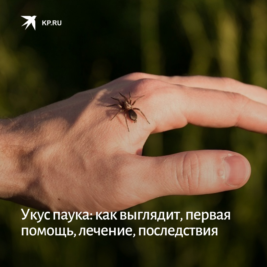 укус после паука фото