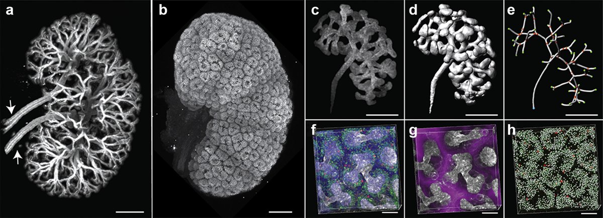 Kidney_Int's tweet image. Clearly imaging and quantifying the kidney in 3D
doi.org/10.1016/j.kint…
@PuellesVictor @AlexKoomz #kidneydevelopment