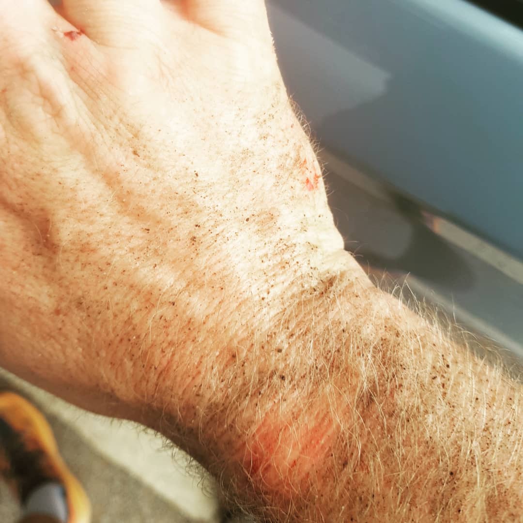 Ibby_tri's tweet photo. Extreme trail running! Super easy 13km on the trails this morning and then proper stacked it in the carpark about 30ft from the car!! 😂 Concrete Ooooouucchh! 😖

#allrunnershere 
#trailrunning #Training #provis #hokafans #polarvantagev #ukrunchat #uktrichat #running #fellover https://t.co/12fapq0f03