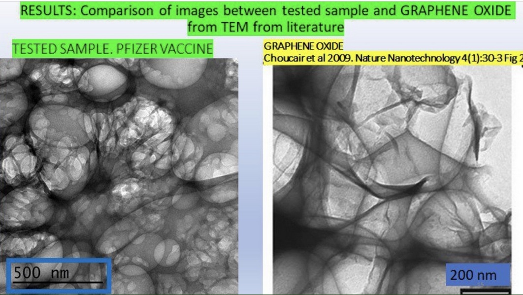 Lütfen RT YAPIN

Aşı Olanlar ve AŞI Denen Sıvıyı Vücuduna Sokmak İsteyenler Lütfen Okuyun

mRNA Aşılarındaki Grafen OKsit Ne İşe Yarar ???

Grafen oksit mucidi ÖJENİK 
(Bilmeyenler Kelimenin Anlamını Öğrensin)
 Ph.D.  Dr. Mylo Canderian ( Korfu, Yunanistan, 1938 doğumlu]