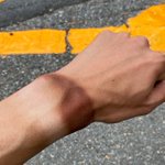 日焼けの跡がすごい･･･!登山の際しっかり日焼け対策をすることの大切さがよく分かるツイートが話題に!