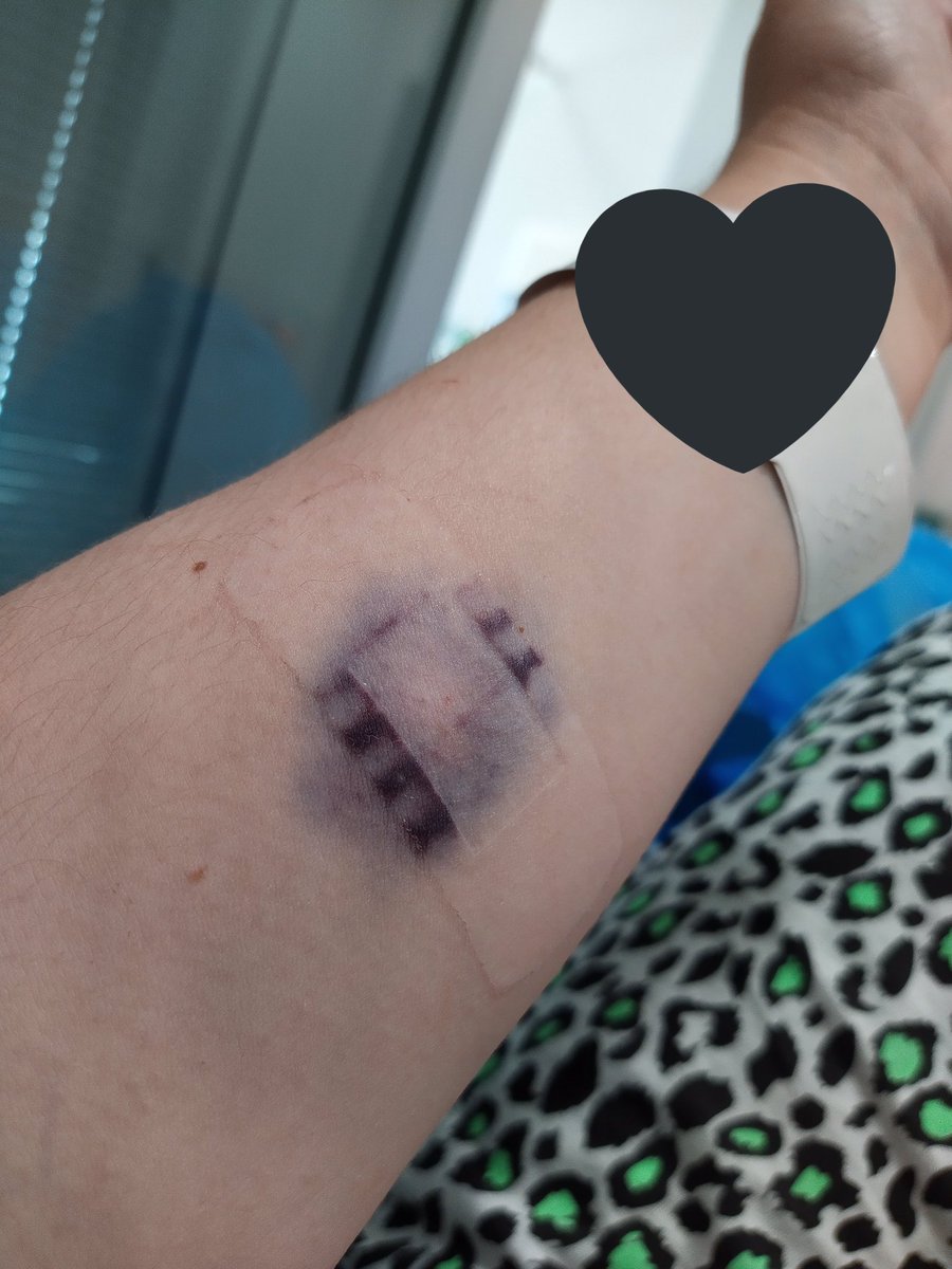 VanillaGoth's tweet photo. Hello my darlings, at 42 Mistress J went &amp; had herself a heart attack last week after a few weeks of ongoing health issues that didn’t present as the obvious signs, but us Mistresses are as much in tune to our bodies as our subs’ ones, so my quick thinking saved my life. TBC 💕 https://t.co/Vc0AC9Tglk