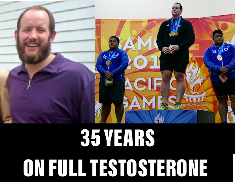 WitchKraft3's tweet photo. @AmyBuchananan @njstone9 @OlierNina @Ashworth101 Laurel Hubbard was born Gavin, male, and competed as male weightlifter and then age 35 started on testosterone blockers. T blockers don’t make you a female. Estrogen doesn’t turn you into a female. Penectomy even doesn’t make a man a female. https://t.co/YD40sdRaAj