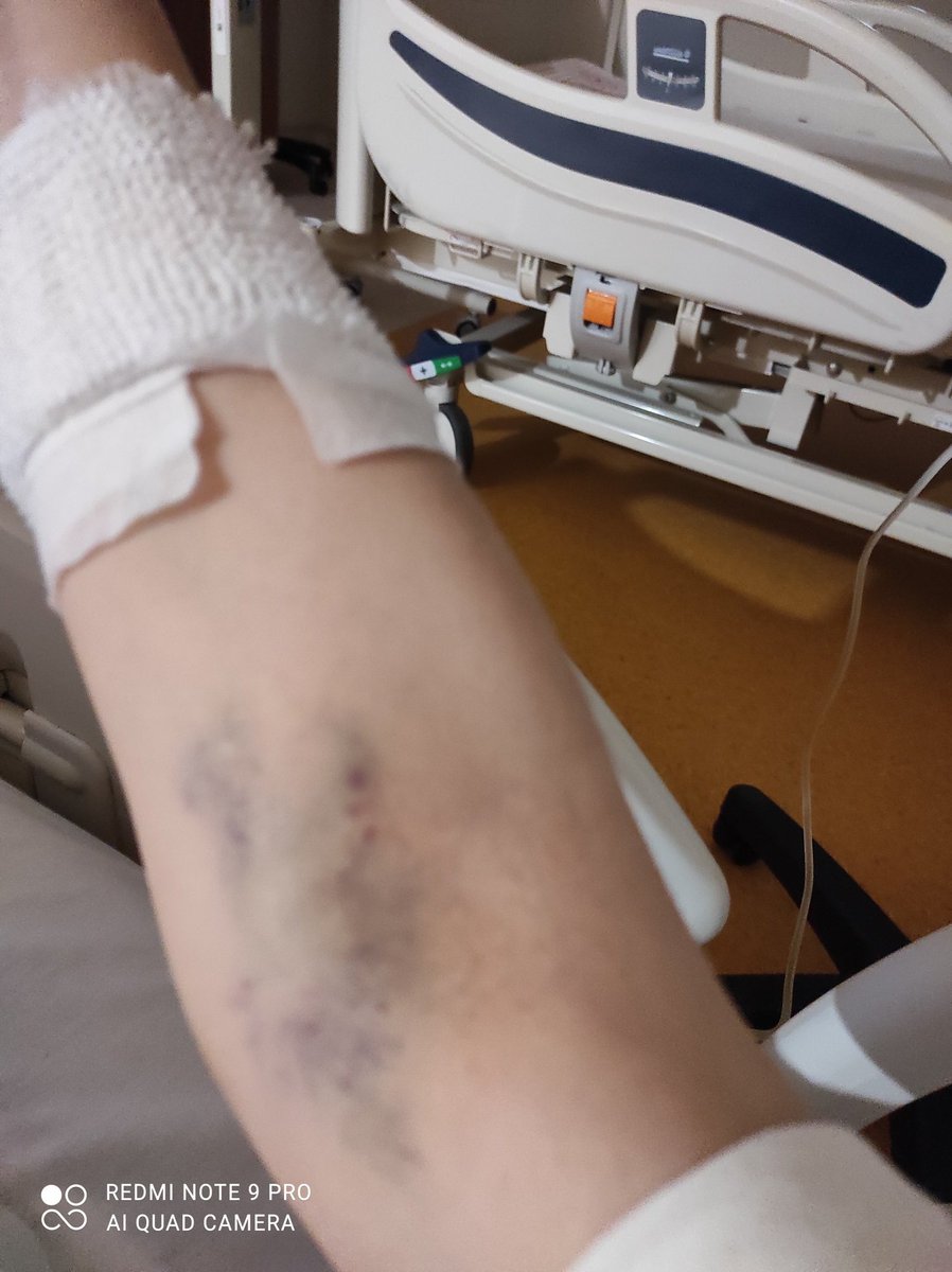 Damar patlatma oynuyoruz , gelsenize ...