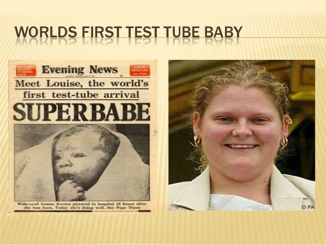 Happy 43rd Birthday to World\s First Test Tube Baby,
Louise Brown.       